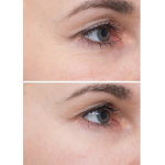 Пілінг-пади з кислотами для глибокого відновлення шкіри Instytutum Flawless Pads