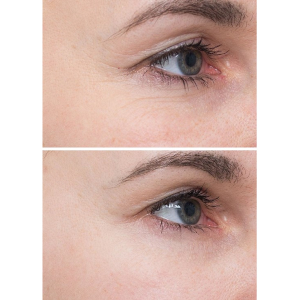 Пілінг-пади з кислотами для глибокого відновлення шкіри Instytutum Flawless Pads