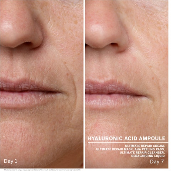 Ампули з гіалуроновою кислотою Babor Hyaluronic Acid Ампули з гіалуроновою кислотою Babor Hyaluronic Acid