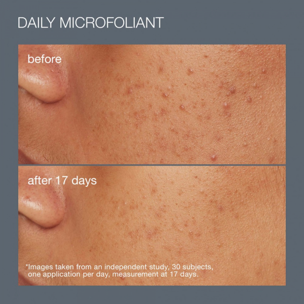 Набір Щоденний догляд Очищення та Сяйво шкіри Dermalogica Best Cleanse + Glow