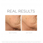 Зміцнююча Anti-age маска Bio Shape Cosmedix