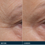Досконала зміцнююча сироватка Про-Колаген Elemis Pro-Collagen Future Restore Serum