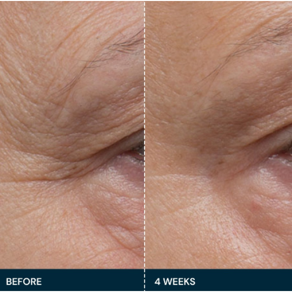 Досконала зміцнююча сироватка Про-Колаген Elemis Pro-Collagen Future Restore Serum