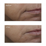 Освітлювальна сироватка з амінокислотами та вітаміном С Perricone MD Brightening Amine Face Lift
