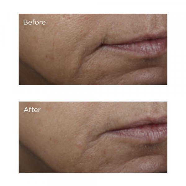 Освітлювальна сироватка з амінокислотами та вітаміном С Perricone MD Brightening Amine Face Lift