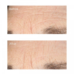  Сироватка від глибоких зморшок Perricone MD Essential Fx Deep Crease Serum 