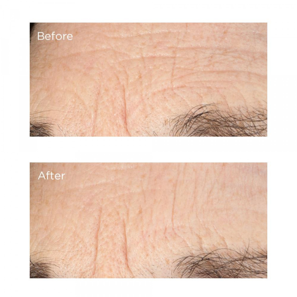 Сироватка від глибоких зморшок Perricone MD Essential Fx Deep Crease Serum 